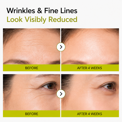 🔥Last Day Promotion 50% OFF - Wagmere® Vita-A Retinal Serum Wrinkle-Lift Tightening cream