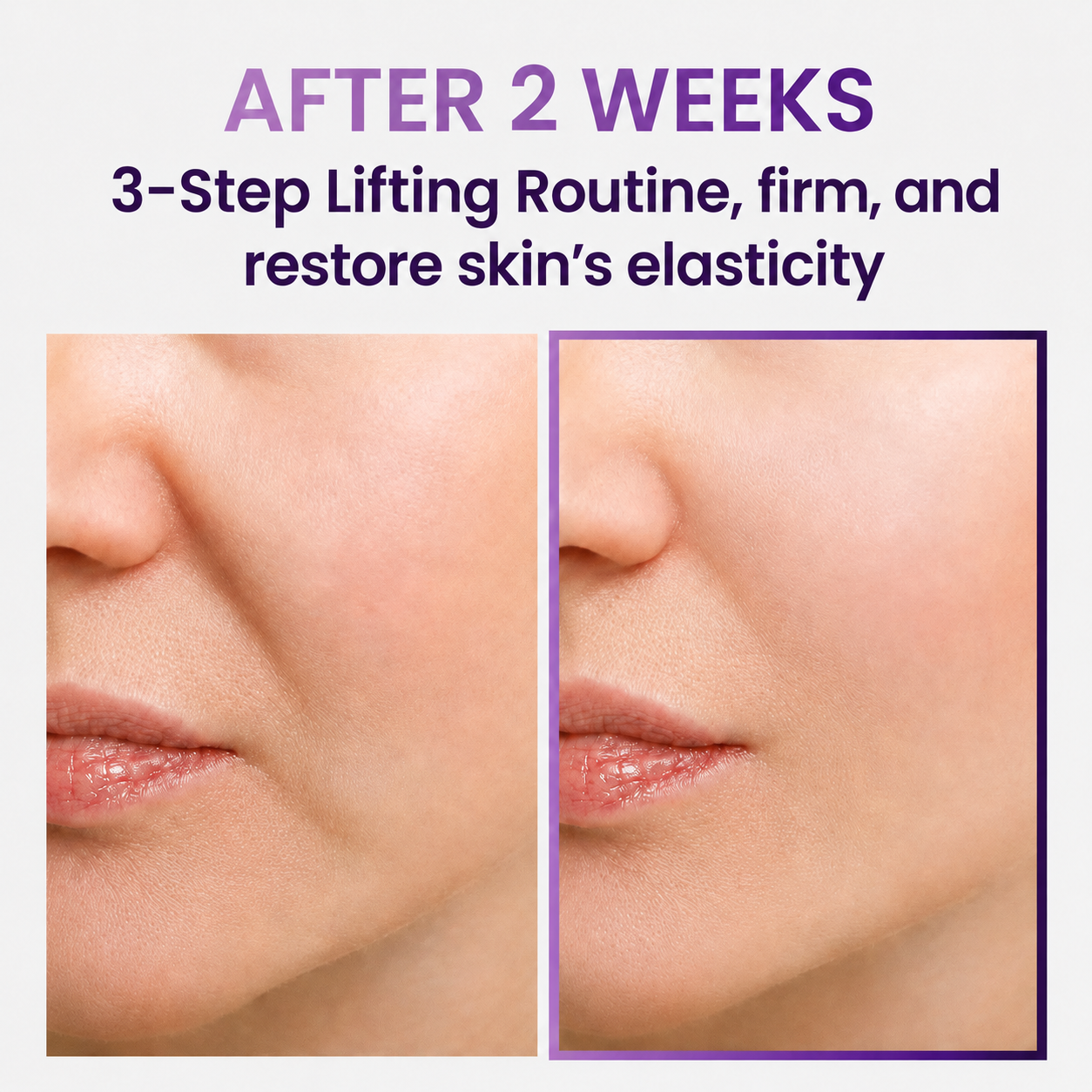 💥 60% OFF Today Only 🔥Wagmere™ 3D Lifting Skincare Set