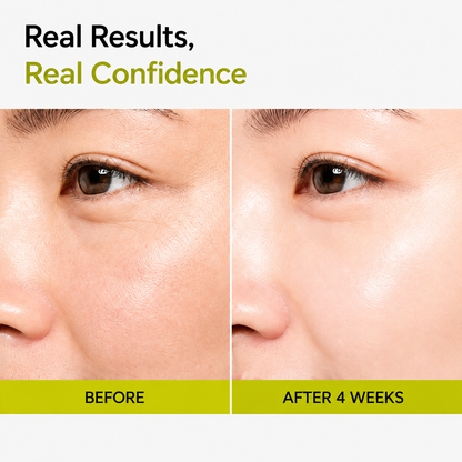 🔥Last Day Promotion 50% OFF - Wagmere® Vita-A Retinal Serum Wrinkle-Lift Tightening cream